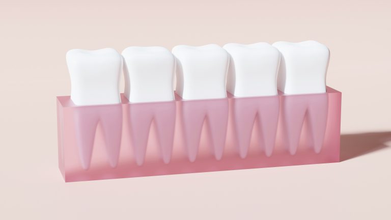Teeth Whitening